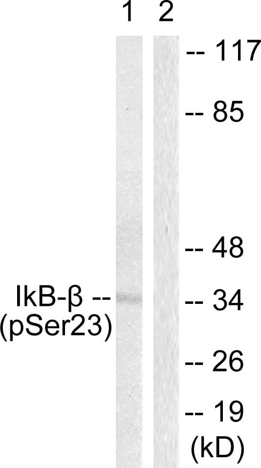 NFKBIB / IKB Beta / IKBB Antibody (phospho-Ser23)