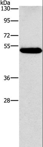 CALCRL / CGRP Receptor Antibody