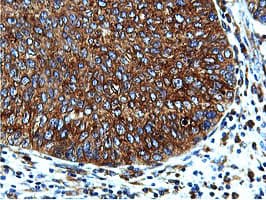 ILVBL Antibody (clone OTI8A12)