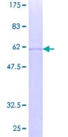 Human STAR Protein (Recombinant GST)