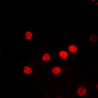 Histone H2B Antibody (Acetyl-Lys5)