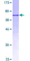 Human GATM / AGAT Protein (Recombinant GST)