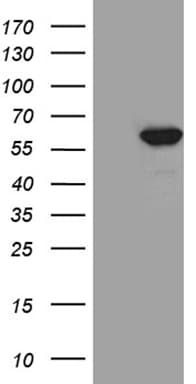 TRXR1 / TXNRD1 Antibody (clone OTI5G3)