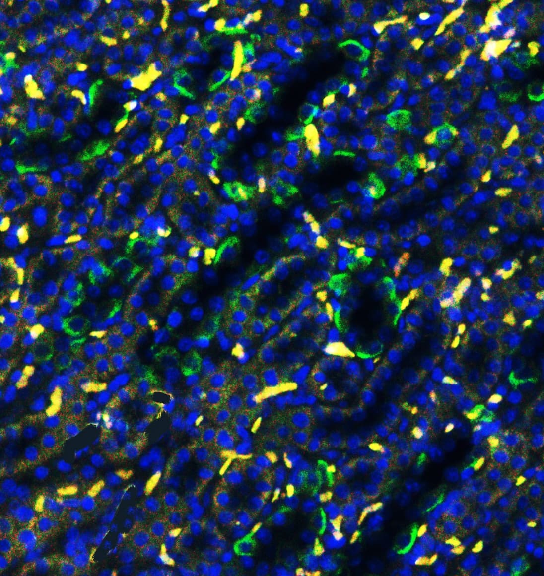 SLC4A1 / Band 3 / AE1 Antibody (aa28-365)