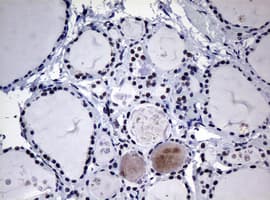 NBN / Nibrin Antibody (aa183-460, clone OTI3C12, Carrier-free)