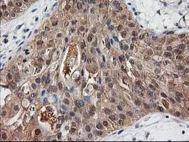 DSTN / Destrin Antibody (clone OTI2F7)