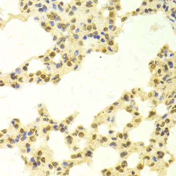 Polyclonal Rabbit anti-Human TMPO / TP / Thymopoietin Antibody (IHC, IF, WB)