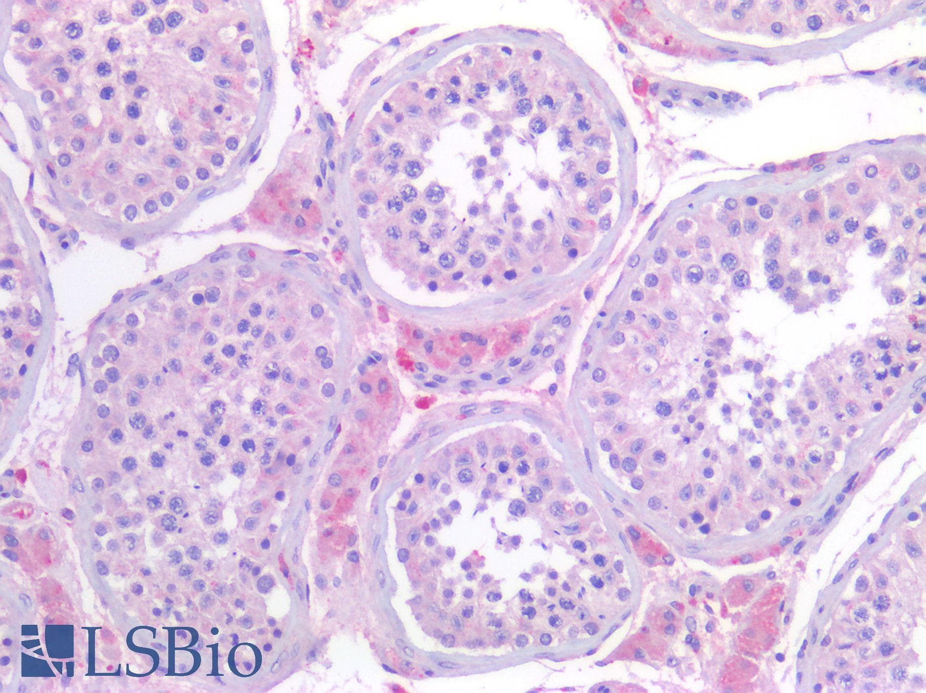 IHC-plus™ CSMD1 Antibody