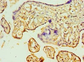 Polyclonal Rabbit anti-Human JMJD6 / PSR Antibody (aa1-320, IHC)