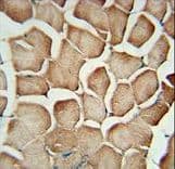 Polyclonal Rabbit anti-Human AP1S1 Antibody (aa5-34, IHC, WB)