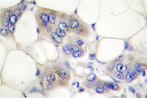 AHR Antibody (Lys32)