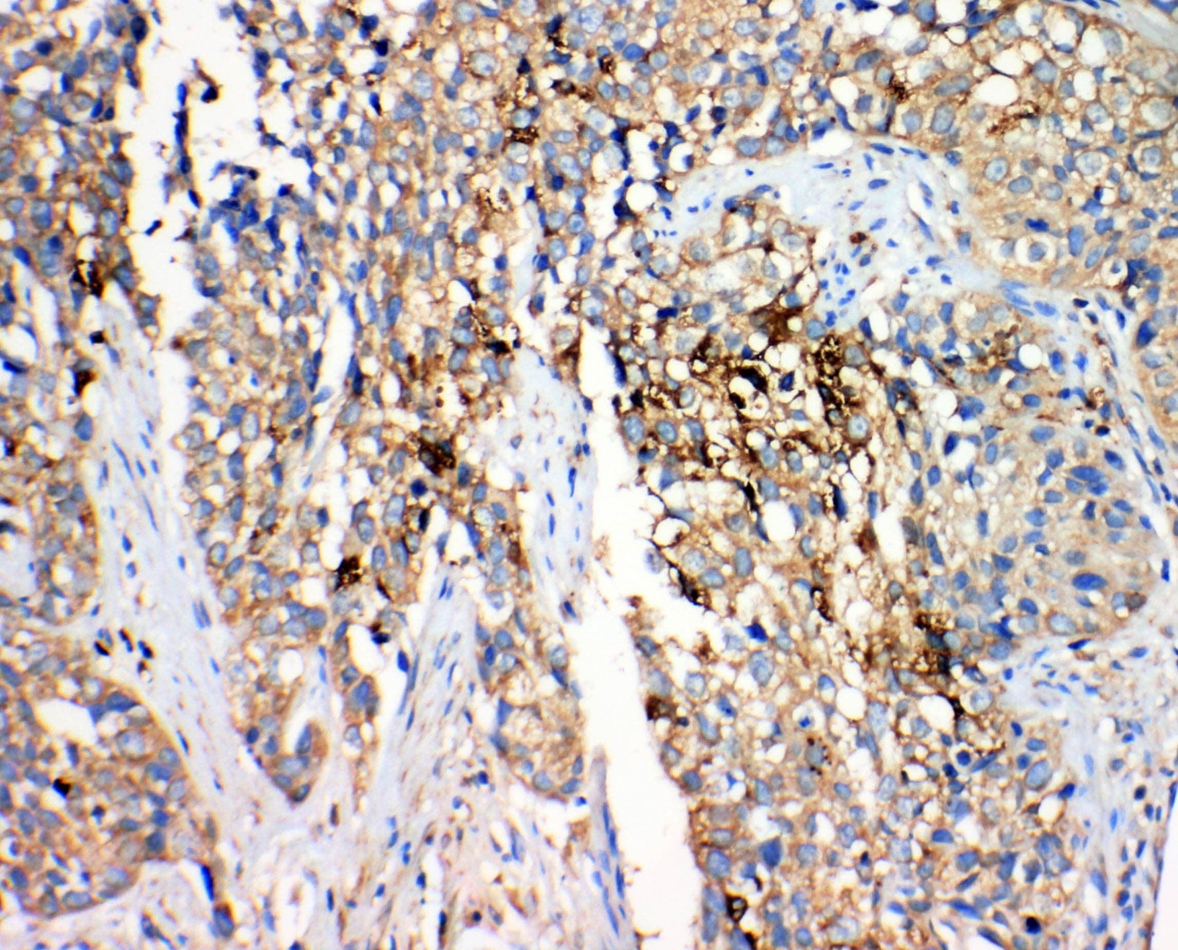 HSD17B4 Antibody (aa744-761)