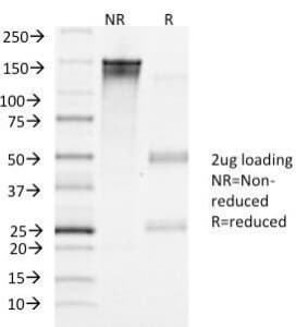 LHCGR / LHR / LH Receptor Antibody (clone LHCGR/1417)