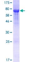 Human WNK1 Protein (Recombinant GST, N-terminus)