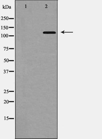 TYK2 Antibody