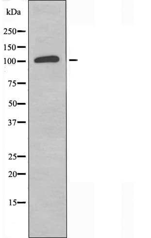 Polyclonal Rabbit anti-Human UBAP2L Antibody (IF, WB)