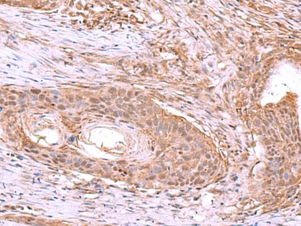 JUNDM2 / JDP2 Antibody