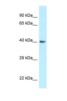 Polyclonal Rabbit anti-Rat GNAQ Antibody (aa147-196, WB)
