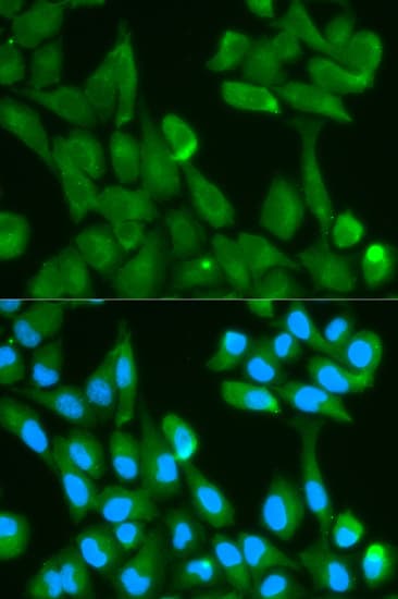 Polyclonal Rabbit anti-Human FABP4 / AP2 Antibody (IHC, IF, WB)