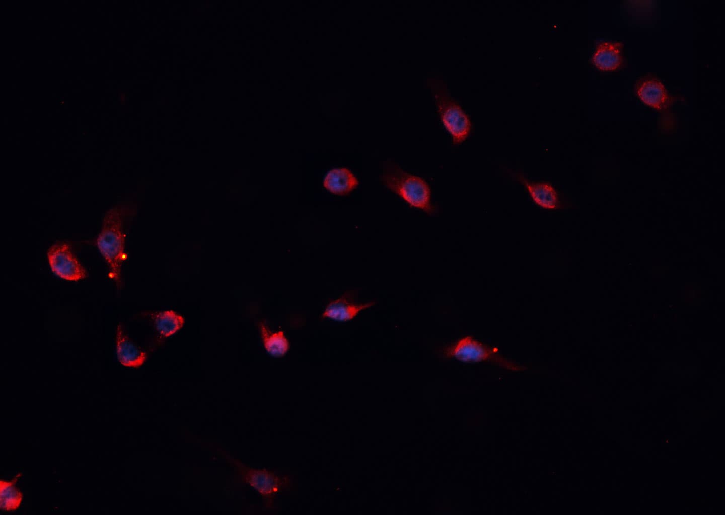 PROS1 / Protein S Antibody