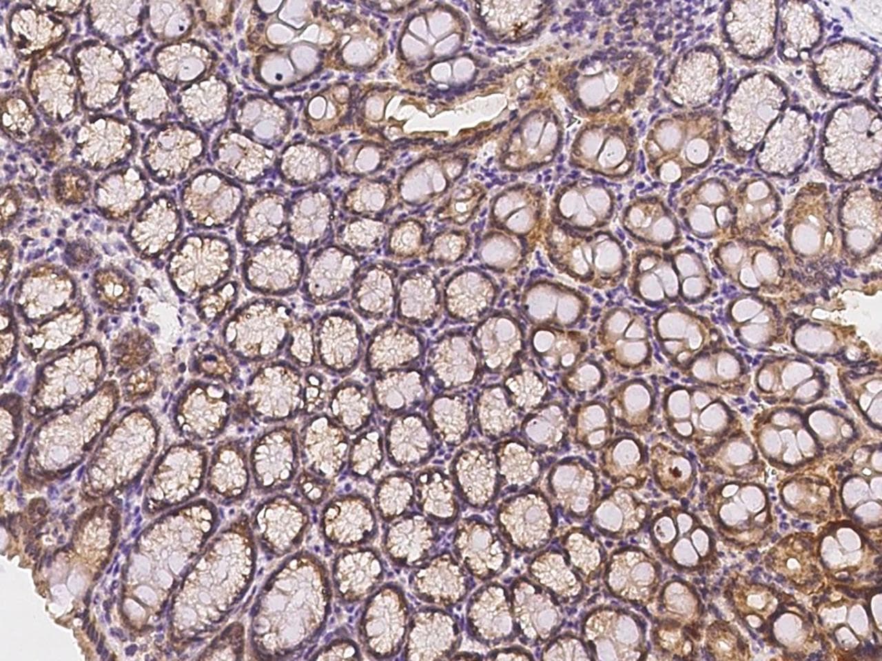 Polyclonal Rabbit anti-Mouse IGF1 Antibody (IHC)