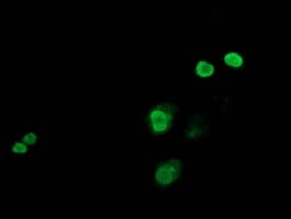 Monoclonal Mouse anti-Human JUN / c-Jun Antibody (clone OTI3G2, IF, WB)