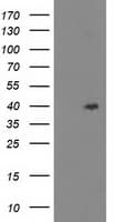 TBC1D21 Antibody (clone OTI7B1, Carrier-free)