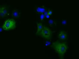 KSP32 / MIOX Antibody (clone OTI3F11)