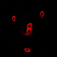 Polyclonal Rabbit anti-Human NCF2 / NOXA2 / p67phox Antibody (IHC, IF, WB)