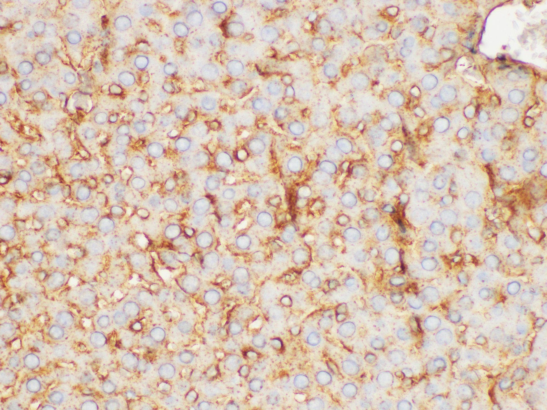 FGB / Fibrinogen Beta Chain Antibody