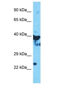 OAS1 Antibody (aa347-396)