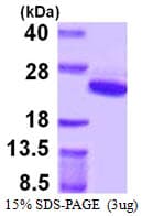 Human ARF5 Protein (Recombinant His)