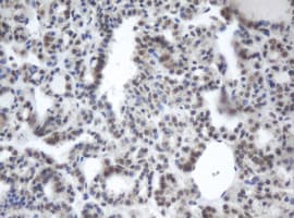 PRR11 Antibody (aa125-360, clone OTI3C8)