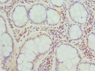 TARS Antibody