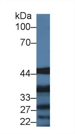 IL13RA1 / IL13R Alpha 1 Antibody (aa203-376, APC)