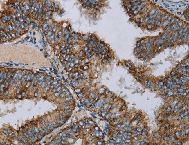 NDUFA9 Antibody