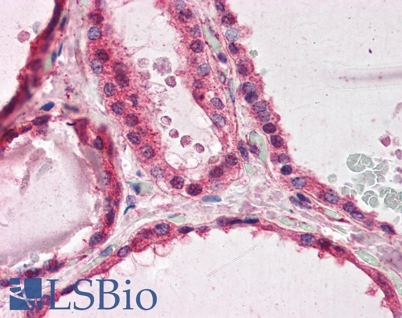IHC-plus™ Polyclonal Goat anti-Human PAFAH1B1 / LIS1 Antibody (aa397-410, IHC, WB)