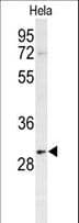 PHB / Prohibitin Antibody (aa89-117)