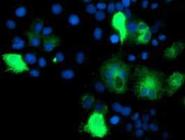 IDS / Iduronate 2 Sulfatase Antibody (clone 3B10, Carrier-free)