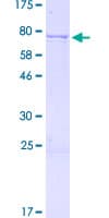 Human DDX49 Protein (Recombinant GST)