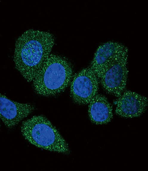 Polyclonal Rabbit anti-Human ACSL4 / FACL4 Antibody (aa236-267, IHC, IF, WB)