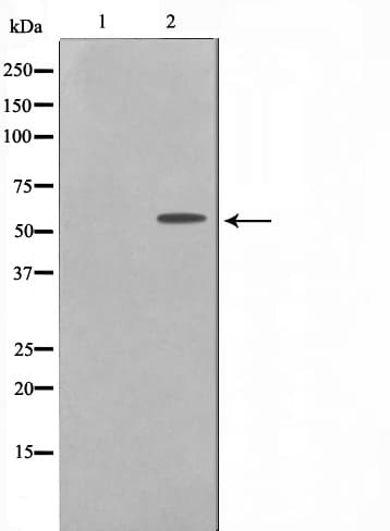 TKFC / DAK Antibody