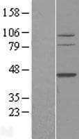 TFB2M Protein (Over-Expression Lysate Myc-DDK (Flag))