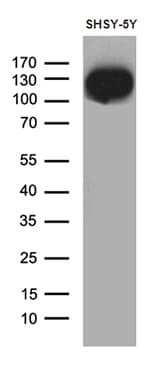Monoclonal Mouse anti-Human DBN1 / Drebrin Antibody (clone OTI4B1, aa2-240, IHC, WB)