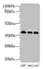 Polyclonal Rabbit anti-Human HNRNPD / AUF1 Antibody (IHC, WB)