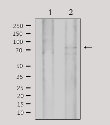 MYST2 / HBO1 Antibody