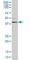 Monoclonal Mouse anti-Human RING1 Antibody (clone 1F4, WB)