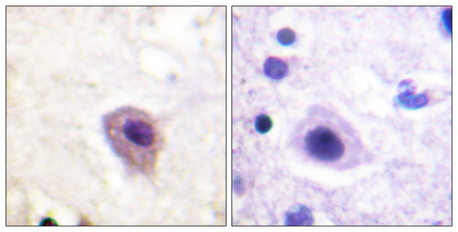 DPYSL2 / CRMP2 Antibody (phospho-Thr514)