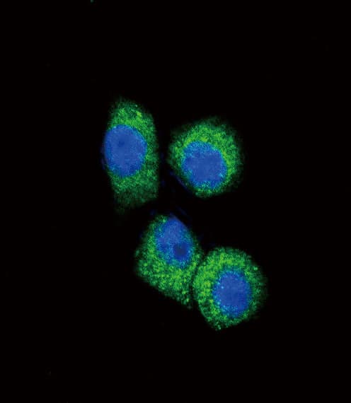 IHC-plus™ CCL2 / MCP1 Antibody (aa62-89)