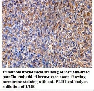 PLD4 / Phospholipase D4 Antibody (aa135-423)